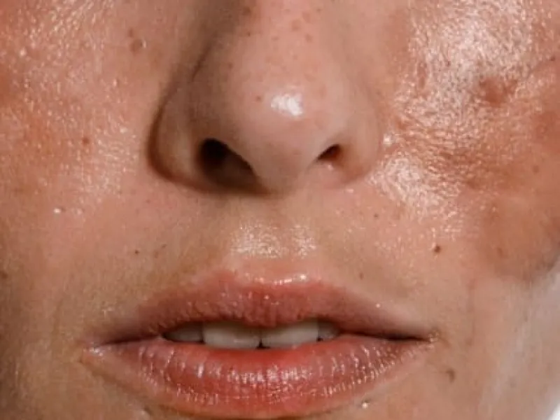 La piel también habla: las señales que solemos confundir con un problema de belleza