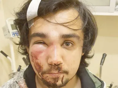 Diputado Espinoza emplaza a Intendente Jürgensen por golpiza a joven dirigente puertomontino: "Hágase responsable"